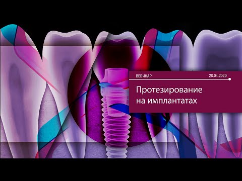 Видео: Протезирование на имплантатах