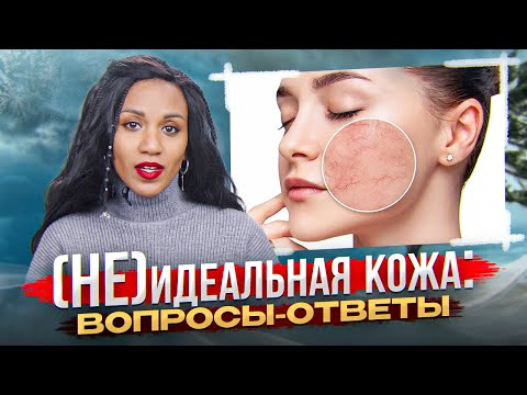 Видео: не(ИДЕАЛЬНАЯ) КОЖА: поры, купероз, чувствительность, жирность, сухость, пигментация // ВОПРОС-ОТВЕТ