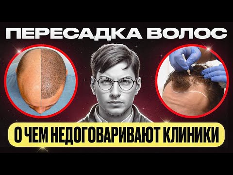 Видео: Почему пересадка волос НЕ решит вашу проблему?