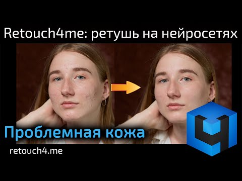Видео: Retouch4me Heal: ретушь на нейросетях. Проблемная кожа