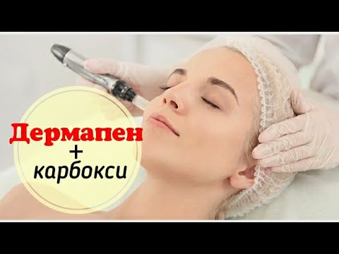 Видео: Карбокситерапия и дермапен (микронидлинг). Сочетанные методики. Эффективная косметология