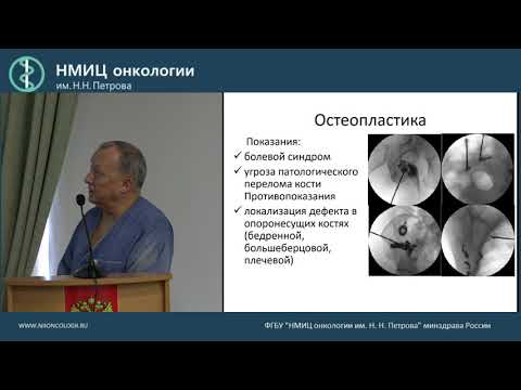 Видео: Место малоинвазивных технологий в хирургии опухолей костей