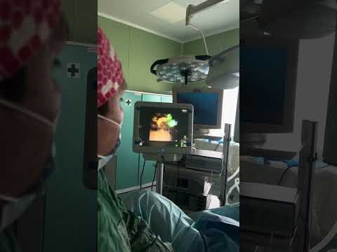 Видео: Ретроградная интраренальная хирургия (РИРХ)