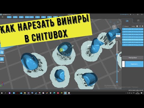 Видео: Печать винир, работа в слайсер chitubox. Как напечатать виниры для пресс литья. часть 1.
