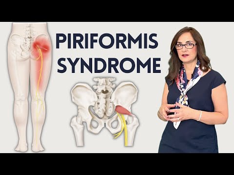 Видео: Как устранить боль в пояснице от грушевидной мышцы