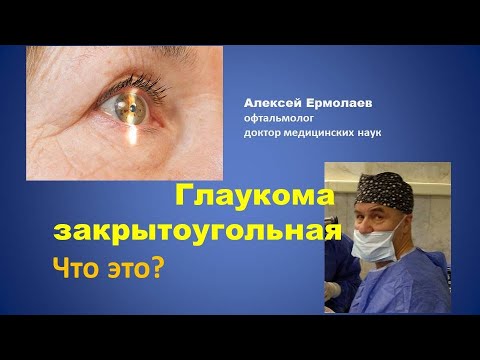 Видео: Глаукома закрытоугольная - что это? Какие ранние признаки? Что при этом делать? #ЛечимсяПравильно