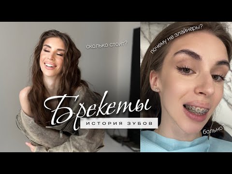 Видео: Ношу брекеты 5 месяцев 🦷 | Капа от бруксизма и для ВНЧС | Почему не элайнеры?