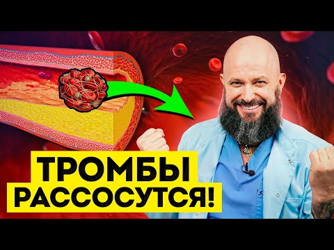 Видео: Это надо знать КАЖДОМУ! 8 рабочих способов почистить сосуды и сердце