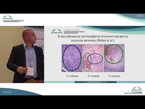 Видео: BrcA1+ рак яичников. Оценка лечебного патоморфоза