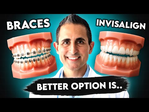 Видео: Брекеты против Invisalign в 2025 году: что на самом деле лучше для вас?