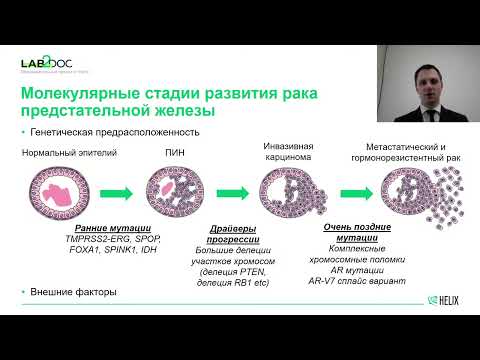 Видео: Молекулярногенетическое обследование при раке предстательной железы