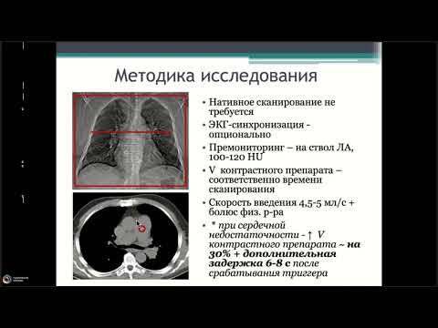 Видео: КТ ангиография легочных артерий методика и основы интерпретации