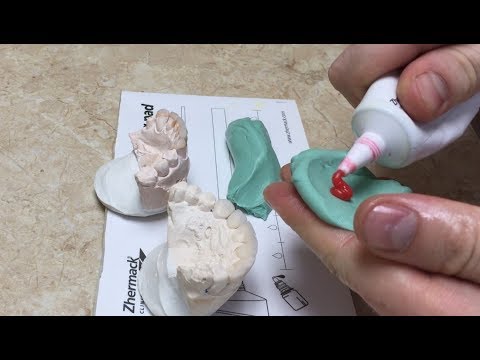 Видео: Как сделать силиконовые ключи . Поднятие прикуса . Wax-up фронтальных зубов. Зубной техник.