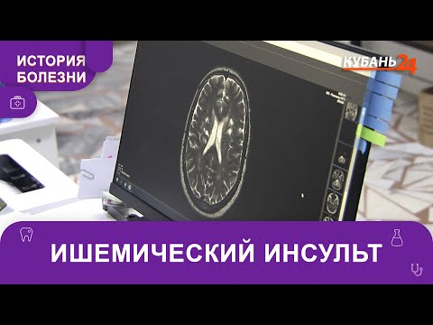 Видео: Ишемический инсульт | История болезни