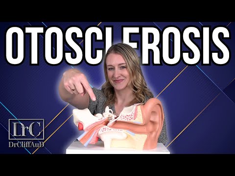 Видео: У вас отосклероз? | Диагностика и варианты лечения