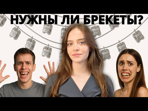 Видео: Зачем ставят брекеты? Как красивая улыбка сделает тебя успешнее