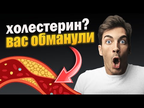 Видео: Вся правда о холестерине: что вам не договаривают врачи