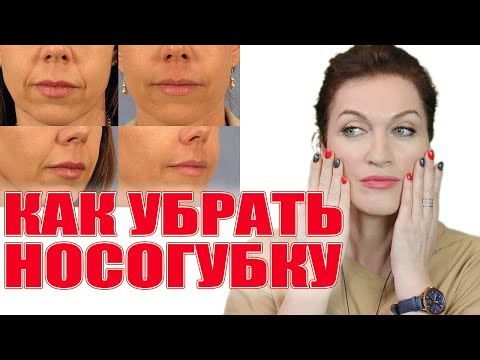 Видео: Как убрать носогубку и заломы! Мой опыт и решения. Что работает , а что нет?