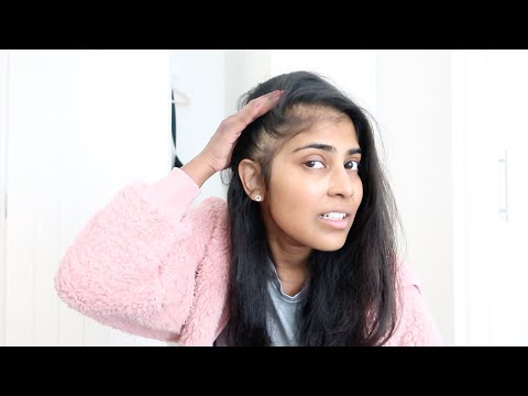 Видео: Волосы становятся хуже! *Путь борьбы с раком 2025*