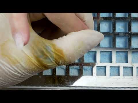 Видео: ОТСЛОЙКИ И СУПЕР КЛЕЙ. коррекция ногтей с отслойками. простой и быстрый дизайн ногтей