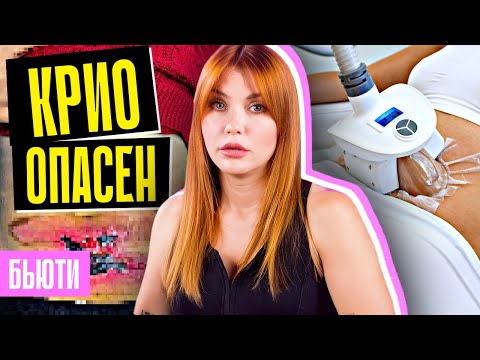 Видео: ЖУТКИЕ ПОСЛЕДСТВИЯ КРИОЛИПОЛИЗА | Должны знать все!