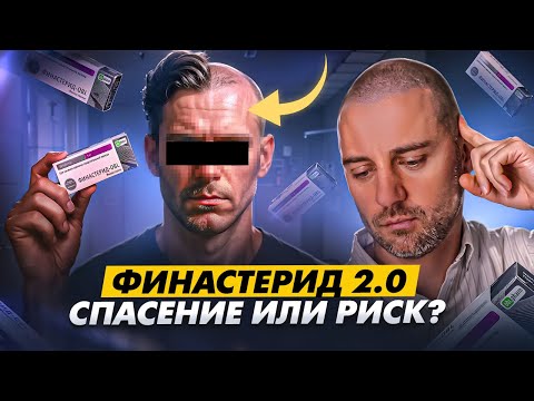 Видео: ФИНАСТЕРИД 2.0 Как спасти результат пересадки: план лечения