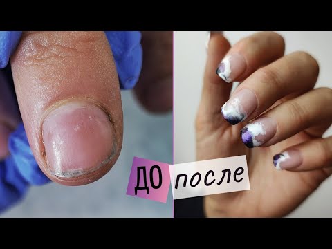 Видео: Ногти лопаются и болят 😑 Рабочие руки: ПРЕОБРАЖЕНИЕ ✨ Маникюр на широкие выпуклые ногти.