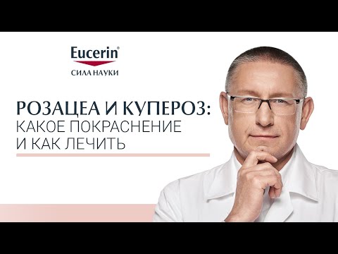Видео: Розацеа и купероз: какое покраснение и как лечить?