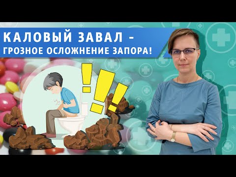 Видео: Каловый завал- самое тяжелое осложнение запора!