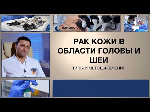 Видео: Рак кожи в области головы и шеи: типы и методы лечения.