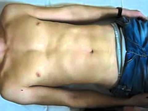 Видео: ПАЛЬПАЦИЯ ЖКТ