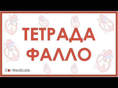 Видео: Тетрада Фалло