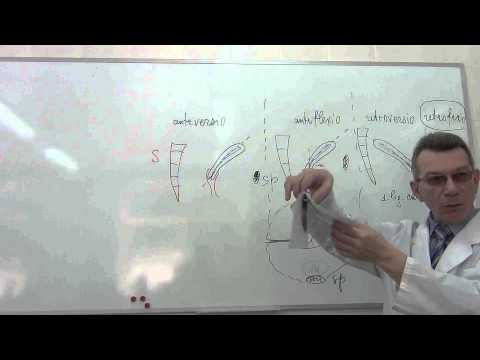 Видео: Положения матки