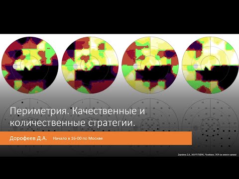 Видео: Погружение в периметрию  Качественные и колличественные стратегии 3/7