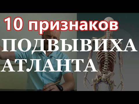 Видео: 📌 10 признаков подвывиха атланта