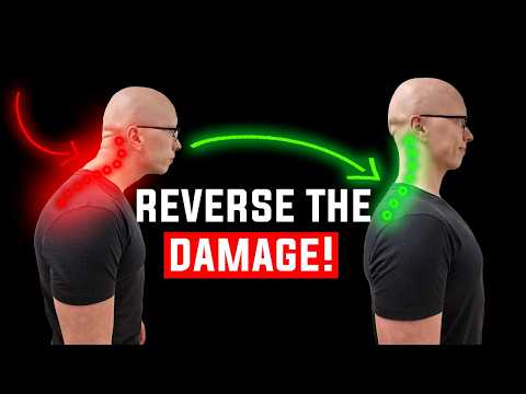 Видео: Это разрушает вашу шею? Легко исправить!