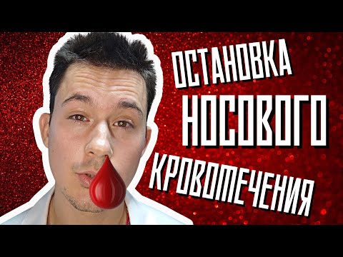 Видео: Кровь из носа | Как остановить носовое кровотечение