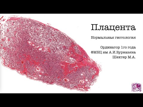 Видео: Плацента  Нормальная гистология