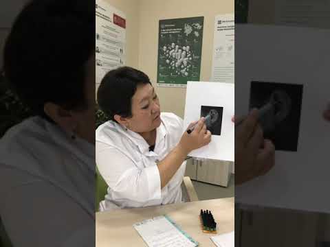 Видео: Рефлексотерапия: какие точки отвечают за иммунитет и улучшают самочувствие?