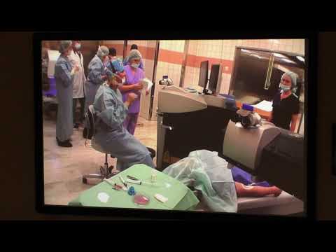 Видео: Передняя послойная кератопластика с использованием фемтосекундной лазерной системы WaveLight FS200