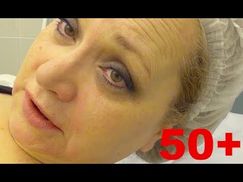 Видео: Лицо сползает, волосы выпадают! ЧТО ДЕЛАТЬ? Похудение в 50+ и возрастные изменения