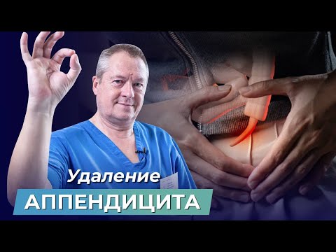 Видео: Почему воспаляется аппендицит? Как самостоятельно предотвратить удаление аппендикса?