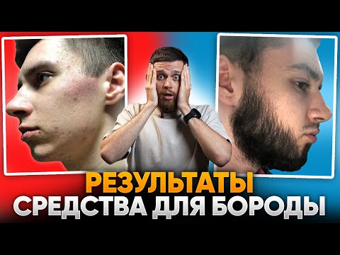 Видео: В 21 ГОД НЕ РОСЛА БОРОДА / Отрастил бороду С НУЛЯ с помощью ксиноксина