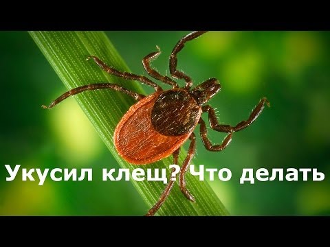 Видео: Укусил клещ, что делать? Укус клеща и насекомых - Доктор Комаровский, неотложная помощь