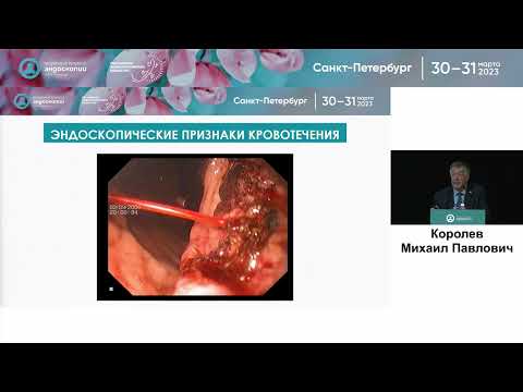 Видео: Экстренная эндоскопия