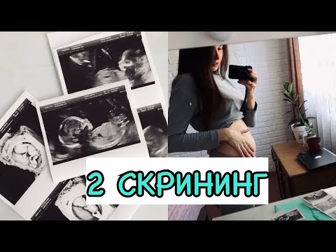 Видео: 20 НЕДЕЛЬ БЕРЕМЕННОСТИ🤍ВТОРОЙ СКРИНИНГ