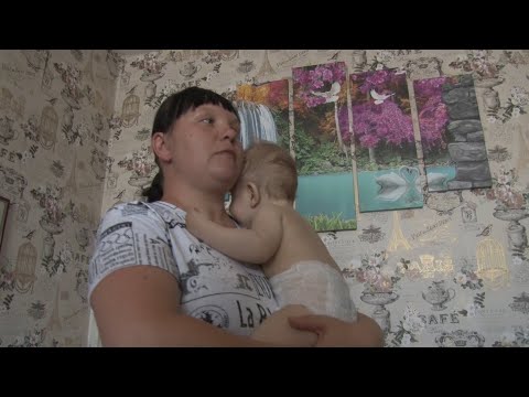 Видео: ДЦП - реабилитация