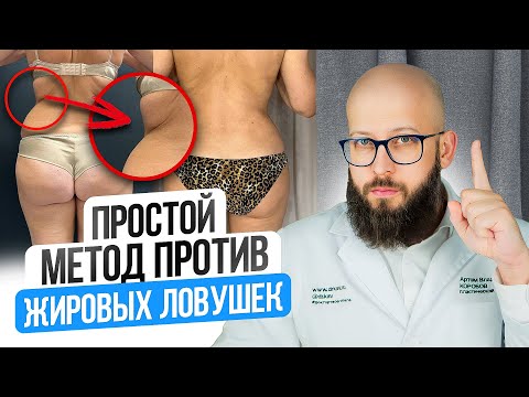 Видео: ЖИРОВЫЕ ЛОВУШКИ! Что это такое и как понять, что у вас есть жировые ловушки?
