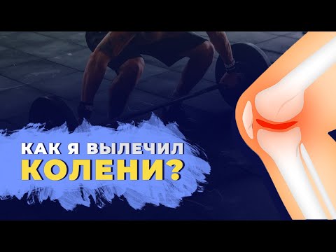 Видео: Как я лечил коленные суставы  Личный опыт и практика лечения суставов.