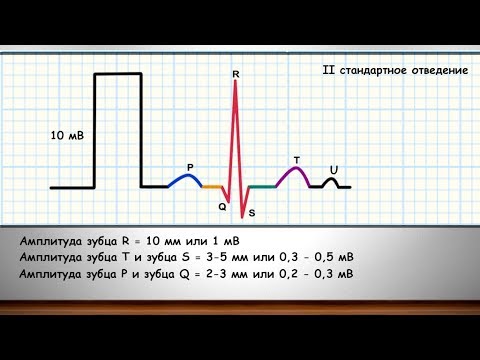 Видео: Фундаментальные знания об ЭКГ часть 5 (тайминги ЭКГ, амплитуда зубцов, разметка ЭКГ)
